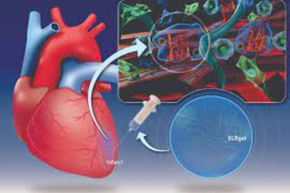 درمان قلب بعد از سکته ممکن شد