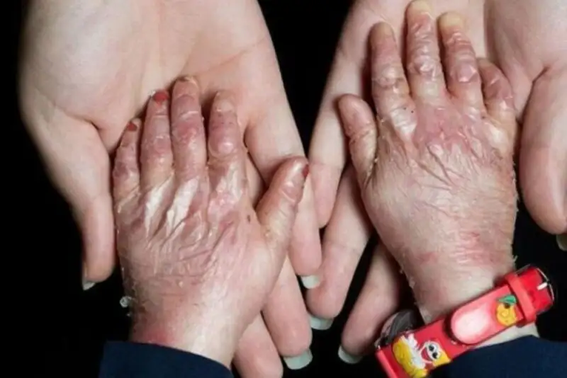 95درصد پروانه‌ای‌ها حاصل ازدواج فامیلی‌اند