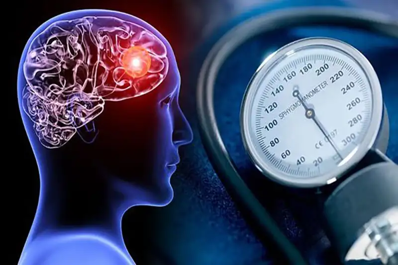 نوسان فشارخون برای مغز خطرناک است