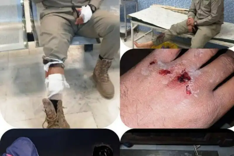 مصدومیت محیط‌بان لرستانی در شلیک شکارچیان غیرمجاز