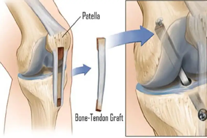 تاندون مصنوعی، ربات‌ها را چابک‌تر می‌کند