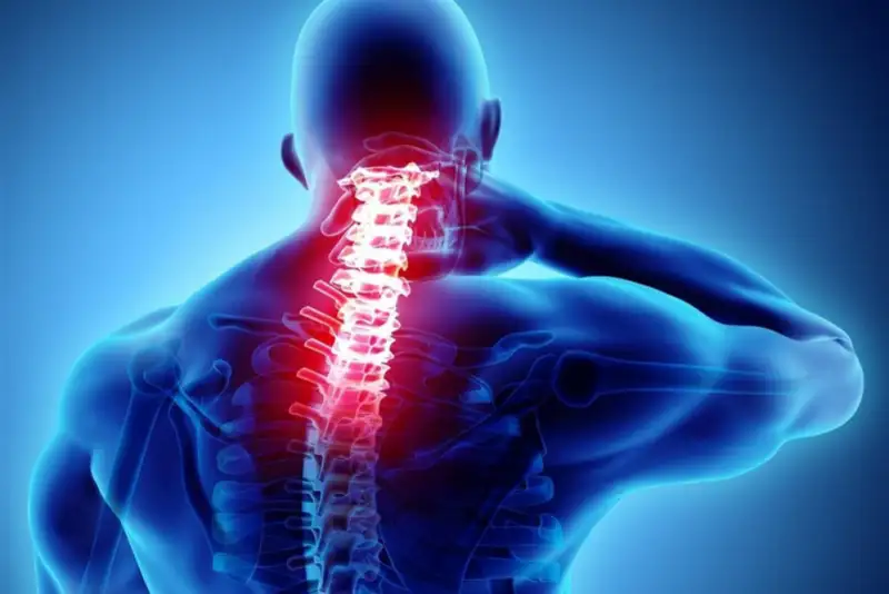 فلج اندام‌ها از عوارض شکستن قلنج توسط ماساژورها