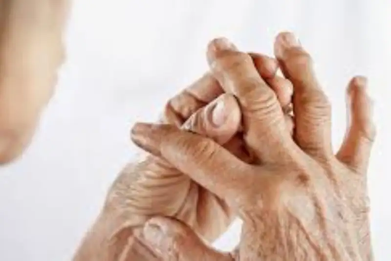 چالش شناسایی بیماری‌های خودایمنی؛ وقتی علائم فریبنده‌اند