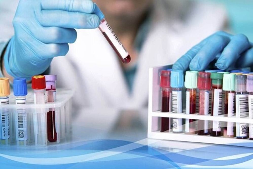 Европейский союз доверяет иранским эталонным лабораториям