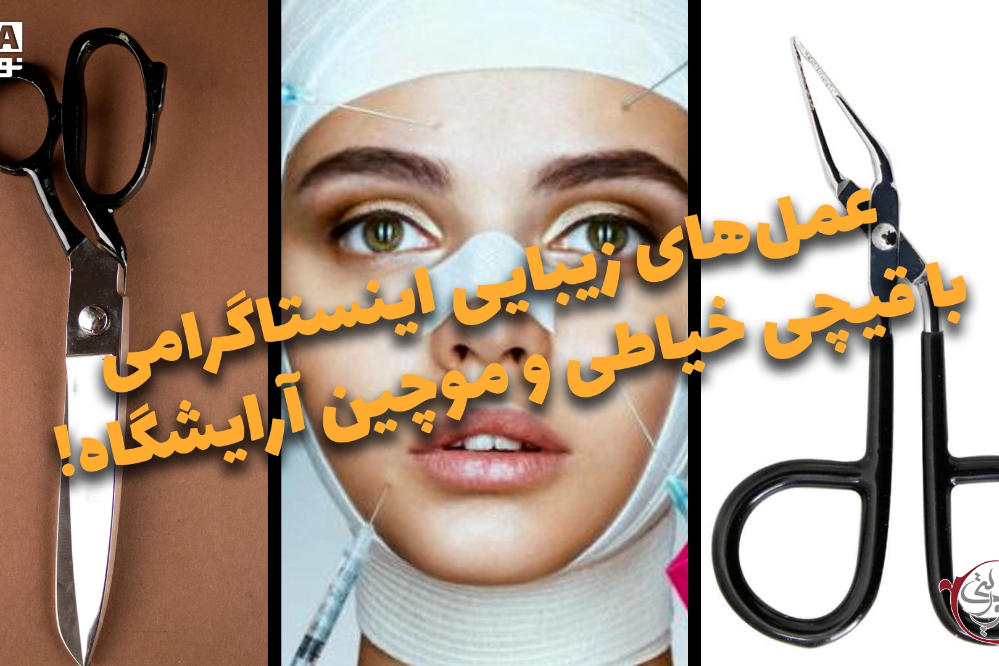 دوفوریتی | عمل‌های زیباییی اینستاگرامی با قیچی خیاطی و موچین آرایشگاه!