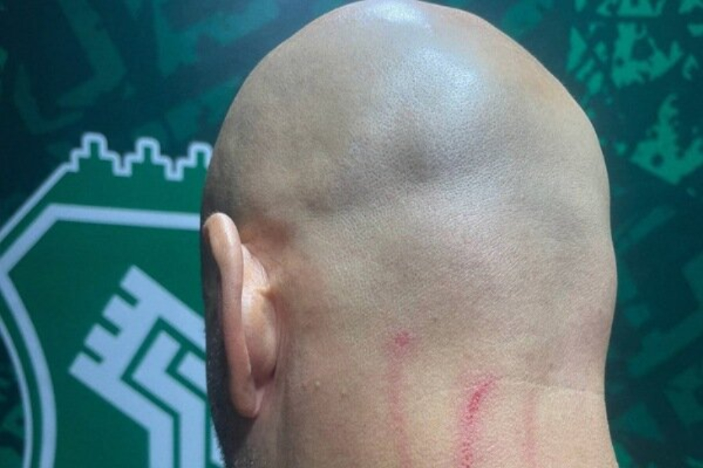 مربی دروازه‌بان‌های استقلال در پایان بازی با خیبر زخمی شد