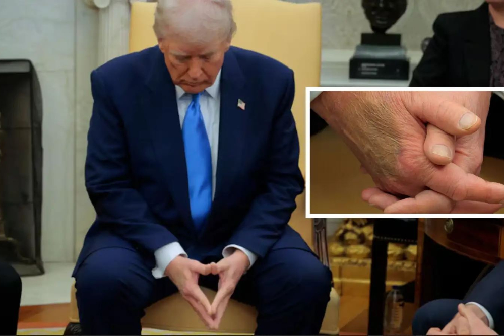 ترامپ شایعات درباره سلامت و خواب‌آلودگی خود را رد کرد