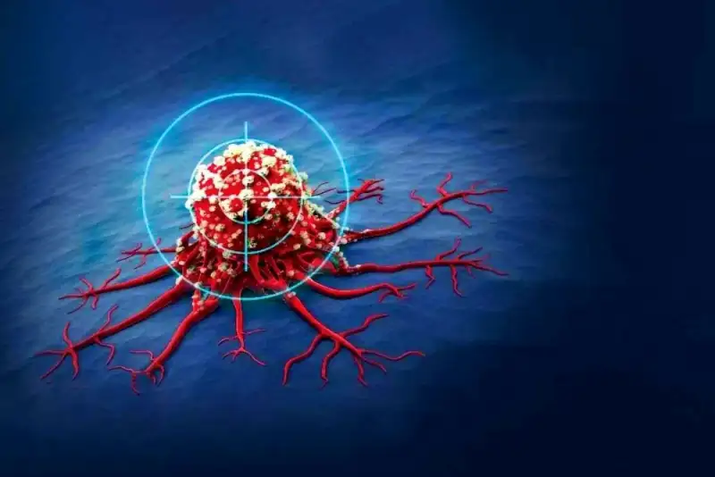 آهن‌ربا به کمک درمان سرطان آمد