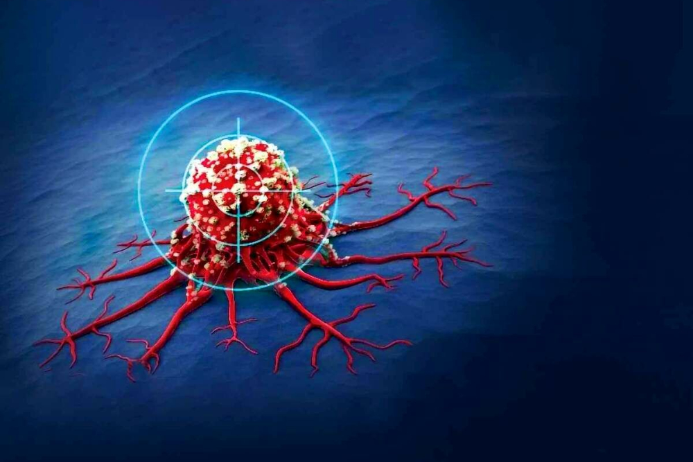 آهن‌ربا به کمک درمان سرطان آمد