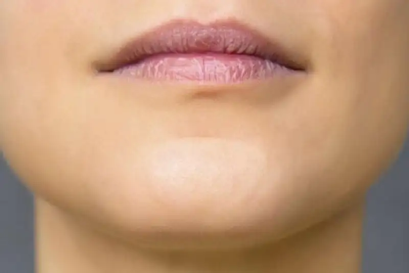 چرا فقط انسان‌ها چانه دارند؟