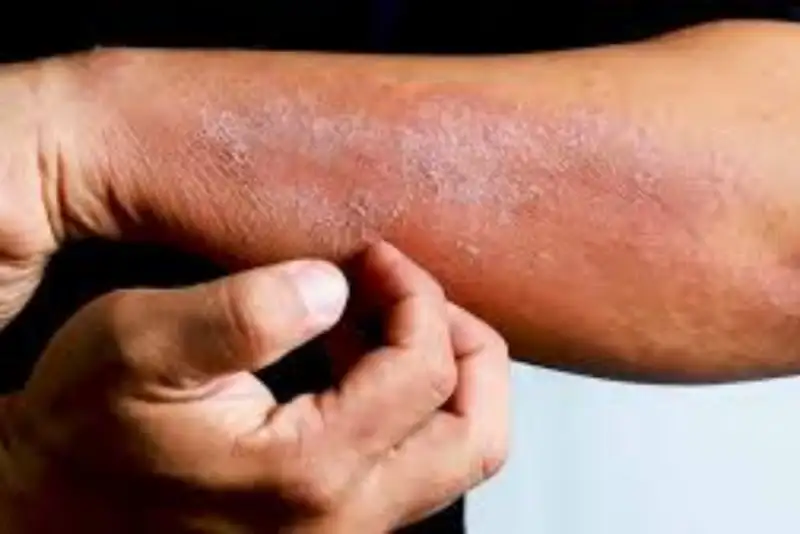 در زمستان دوش آب سرد بهتر است یا داغ؟