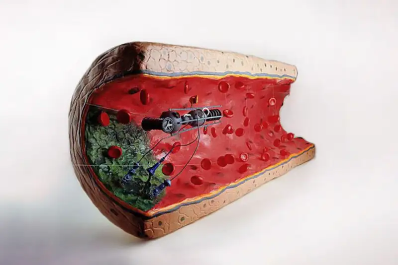 میکروذرات خودران وارد حوزه دارورسانی می‌شوند