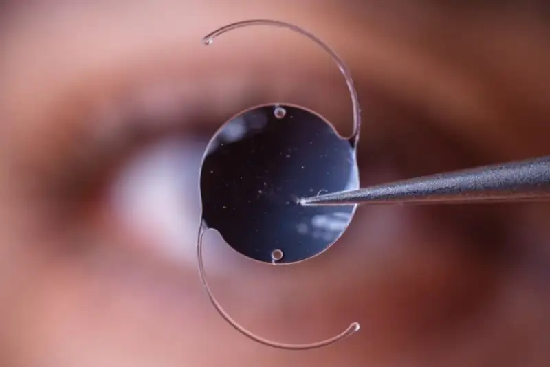 کاهش سن ابتلا به آب‌مروارید