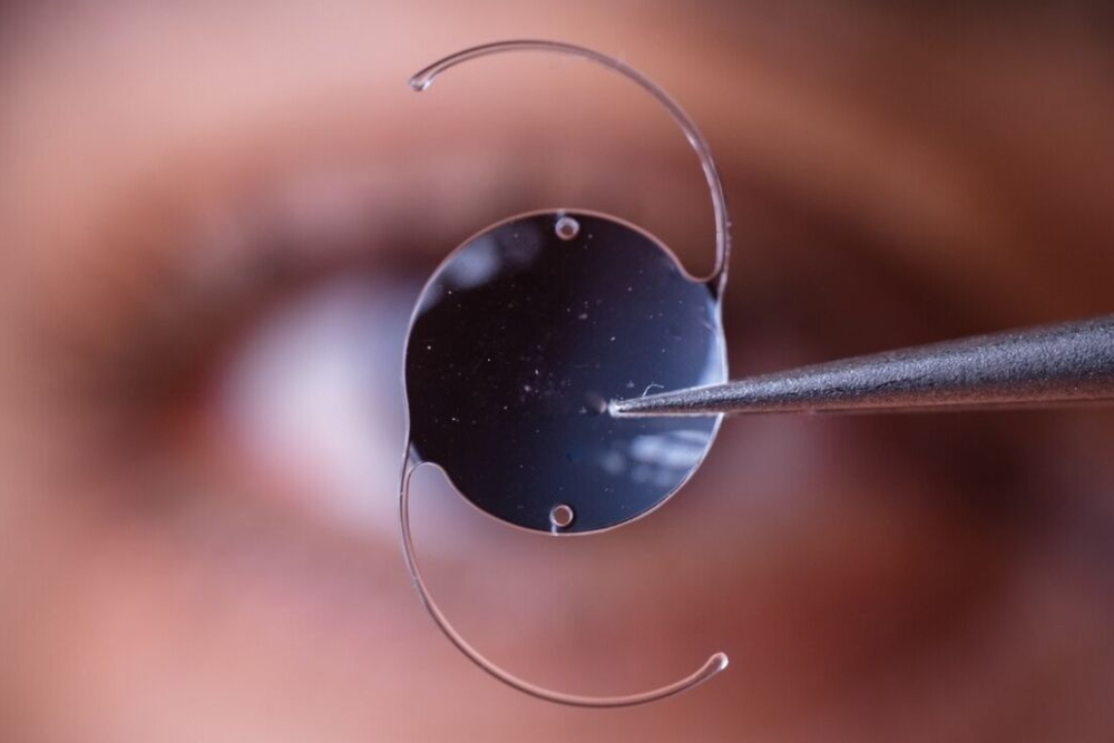 کاهش سن ابتلا به آب‌مروارید