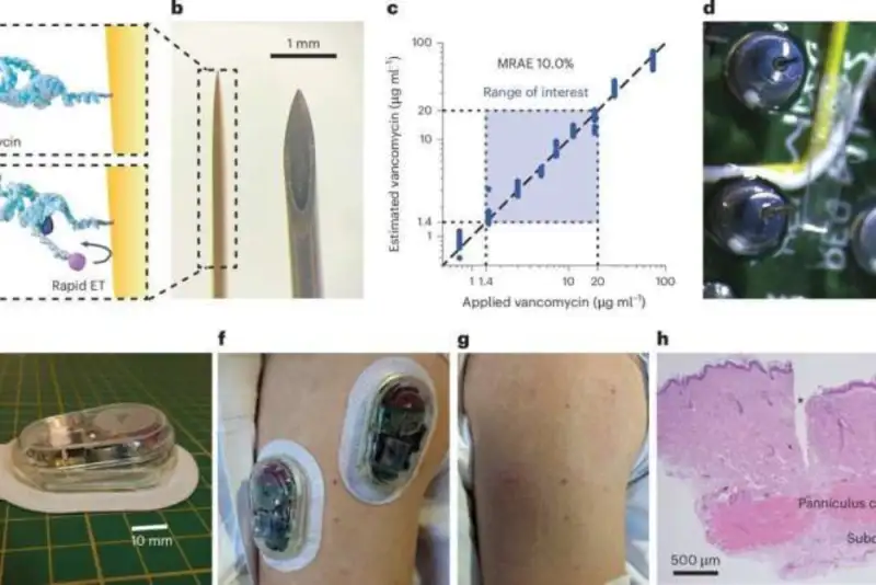 ساخت چسب حسگر هوشمند که بدن بیمار را رصد می‌کند