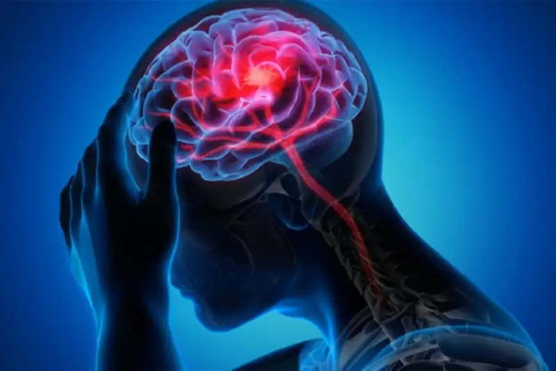 علامت هشدار سکته مغزی در 90 روز آینده