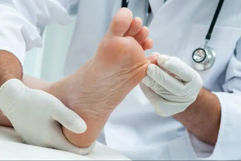 کشف درمان بهبود زخم‌های التیام‌ناپذیر برای جلوگیری از قطع عضو