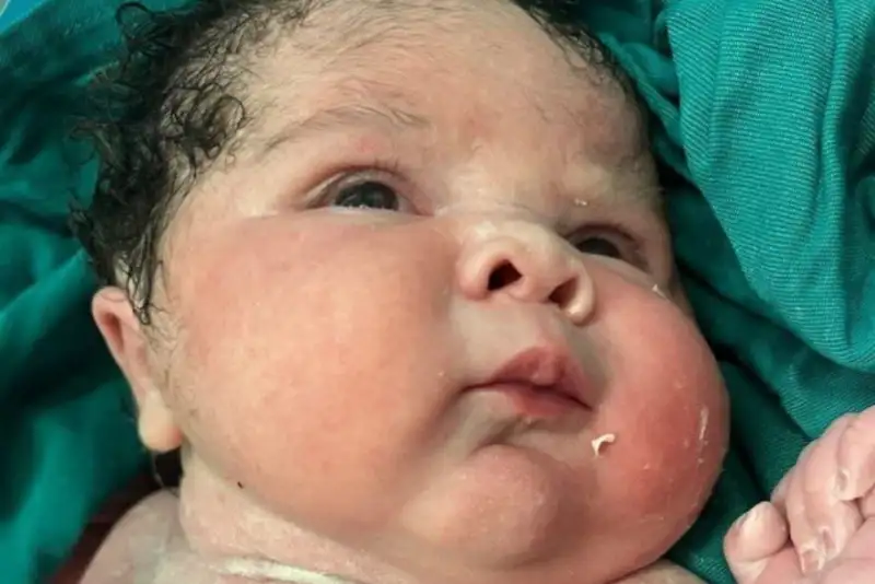 تولد نوزاد 6 کیلو و 100 گرمی در بیمارستان کوثر سنندج