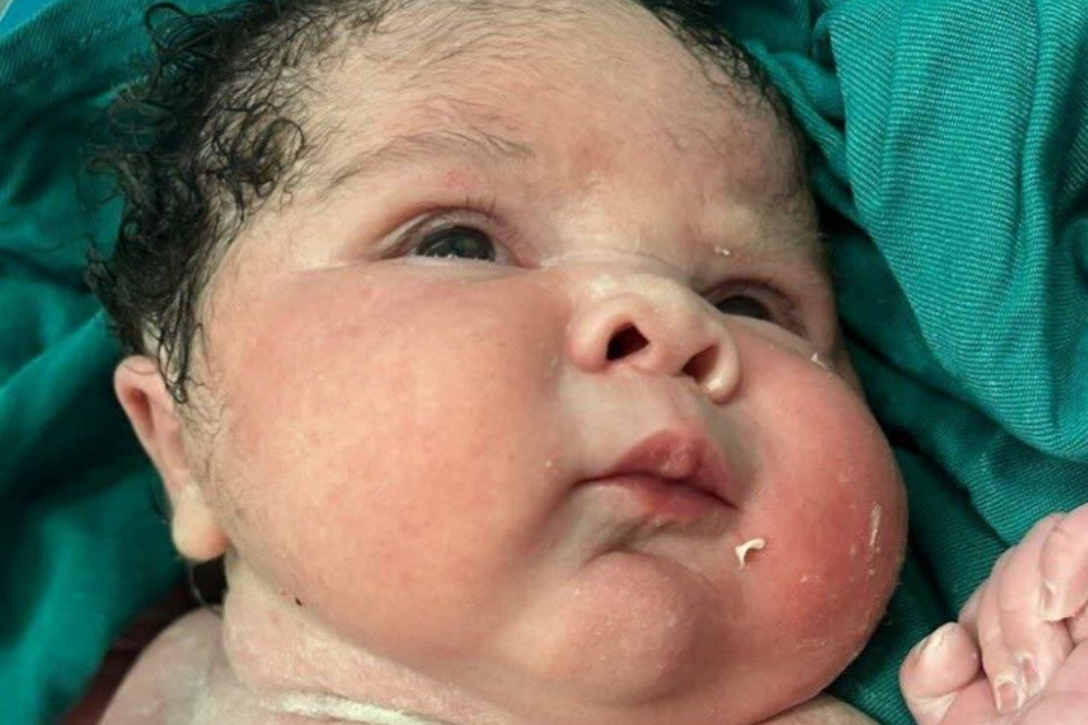 تولد نوزاد 6 کیلو و 100 گرمی در بیمارستان کوثر سنندج