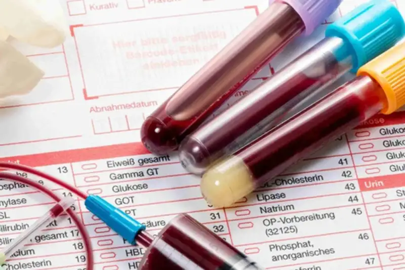 تحول در تشخیص زودهنگام سرطان با کیت غیرتهاجمی محققان ایرانی