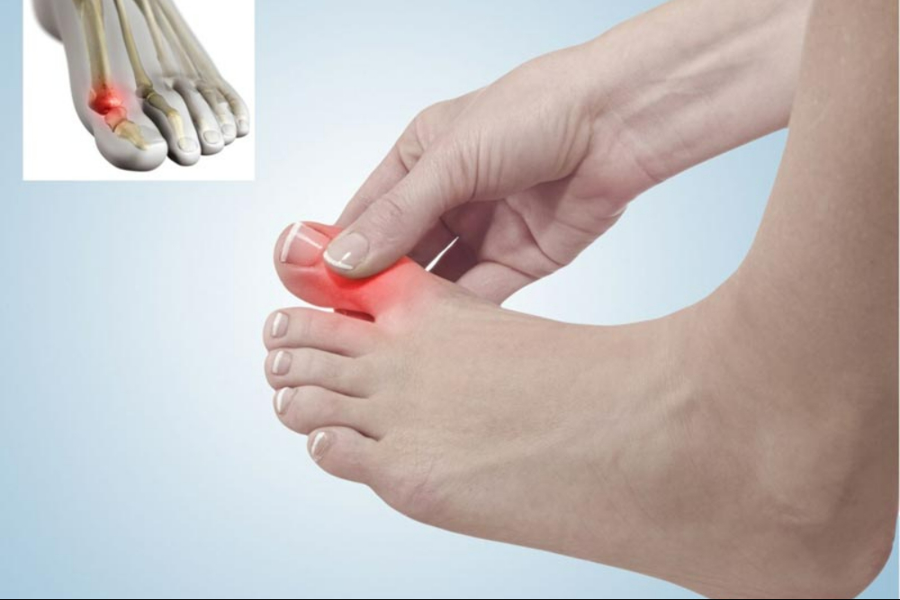 دلایل شایع التهاب مفصلی در انگشتان پا