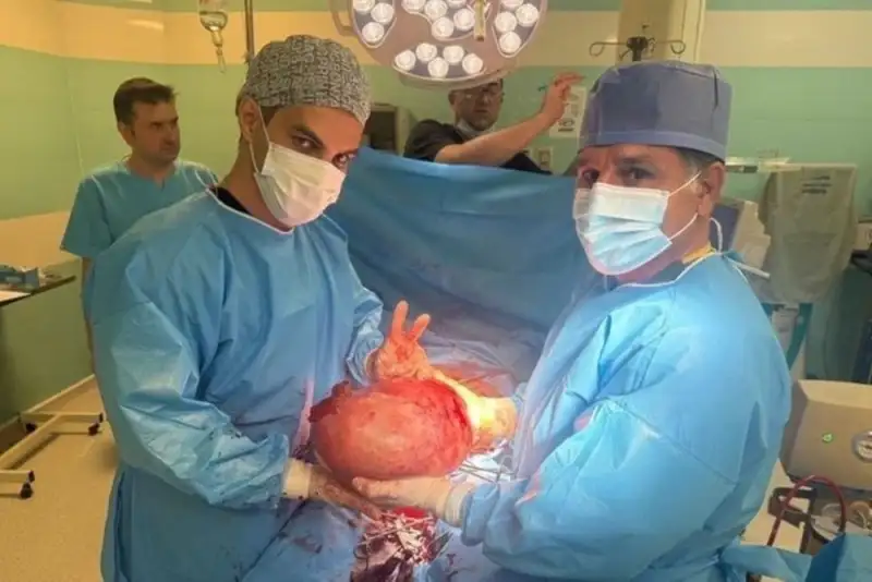 خارج کردن توده 7 کیلوگرمی از بدن یک بانوی کوهدشتی