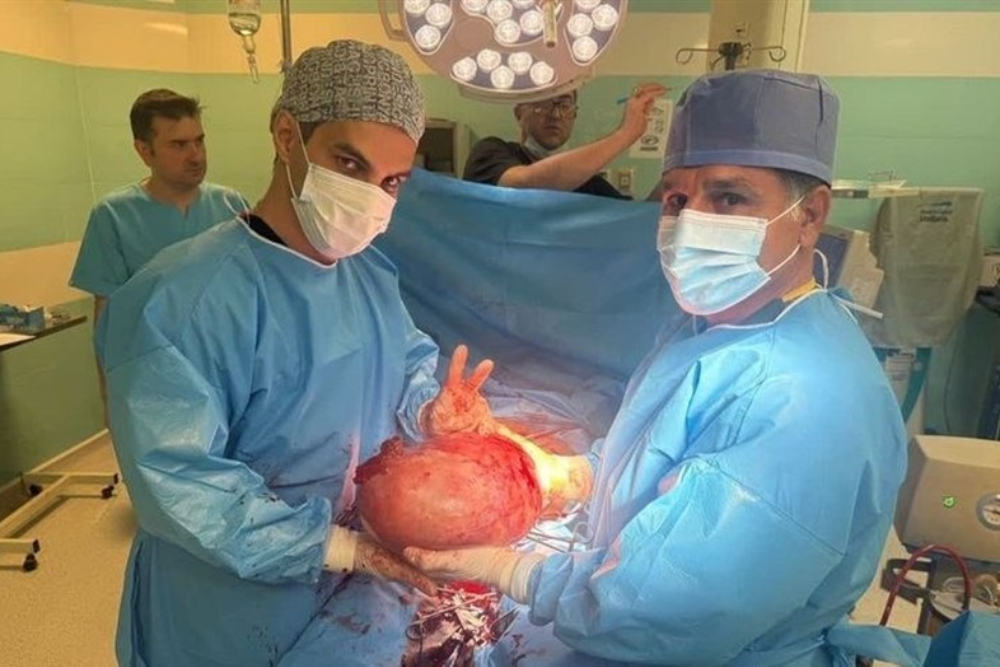 خارج کردن توده 7 کیلوگرمی از بدن یک بانوی کوهدشتی