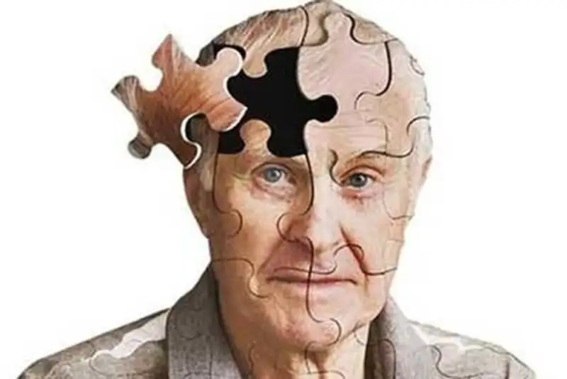 آلزایمر در مسیر انفجار آماری؛ مبتلایان تا 2050 به 152 میلیون نفر می‌رسند