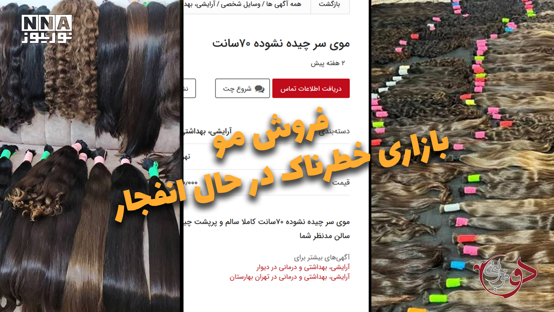 دوفوریتی | فروش مو، بازاری خطرناک در حال انفجار