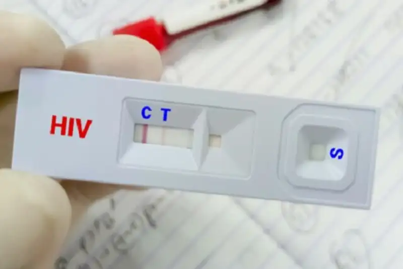 کاهش سهم «اعتیاد» در انتقال HIV؛ تغییر الگوی انتقال بیماری در ایران