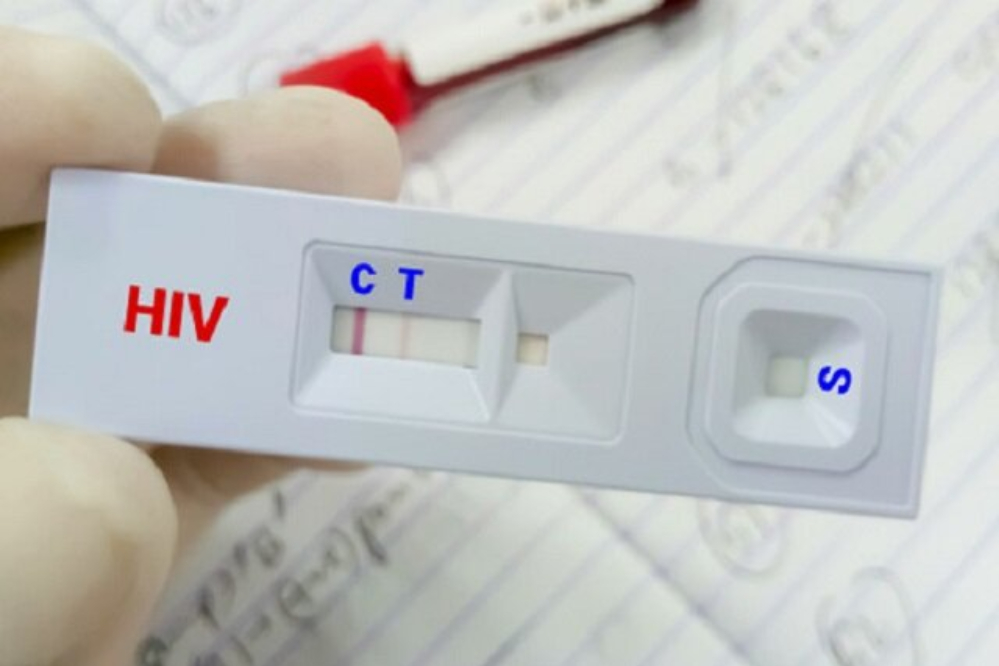 کاهش سهم «اعتیاد» در انتقال HIV؛ تغییر الگوی انتقال بیماری در ایران